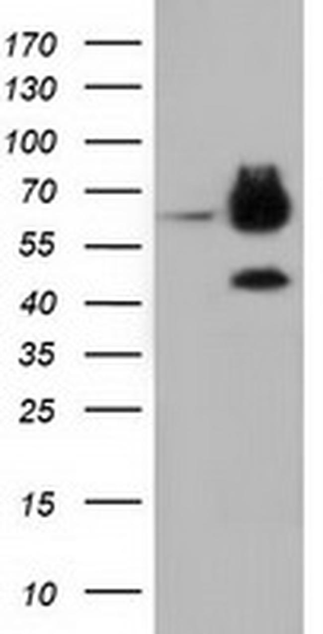 EPHX2 Antibody in Western Blot (WB)