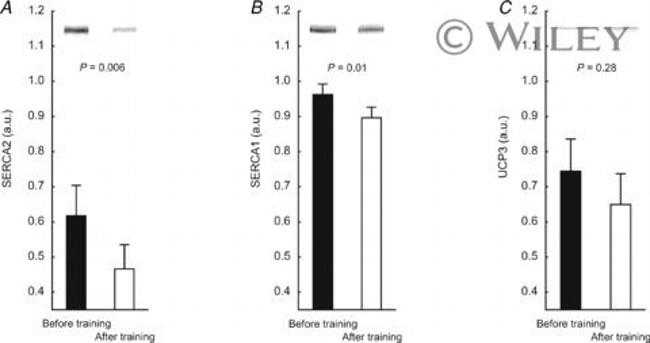 SERCA2 ATPase Antibody in Western Blot (WB)