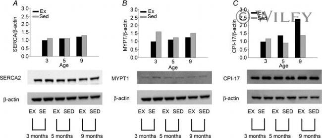 SERCA2 ATPase Antibody in Western Blot (WB)