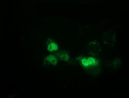 EPM2AIP1 Antibody in Immunocytochemistry (ICC/IF)