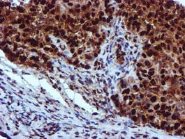 EPM2AIP1 Antibody in Immunohistochemistry (Paraffin) (IHC (P))