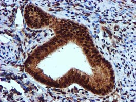 EPM2AIP1 Antibody in Immunohistochemistry (Paraffin) (IHC (P))