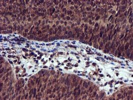 EPM2AIP1 Antibody in Immunohistochemistry (Paraffin) (IHC (P))