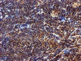 EPM2AIP1 Antibody in Immunohistochemistry (Paraffin) (IHC (P))