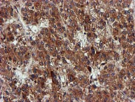 EPM2AIP1 Antibody in Immunohistochemistry (Paraffin) (IHC (P))