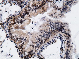 EPM2AIP1 Antibody in Immunohistochemistry (Paraffin) (IHC (P))