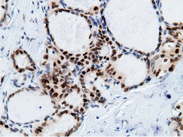 EPM2AIP1 Antibody in Immunohistochemistry (Paraffin) (IHC (P))