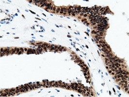 EPM2AIP1 Antibody in Immunohistochemistry (Paraffin) (IHC (P))