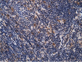 EPM2AIP1 Antibody in Immunohistochemistry (Paraffin) (IHC (P))