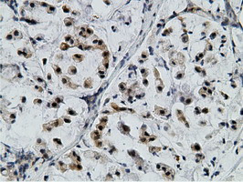 EPM2AIP1 Antibody in Immunohistochemistry (Paraffin) (IHC (P))