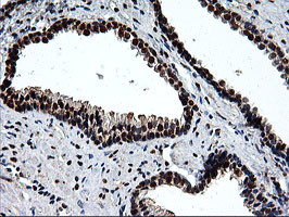 EPM2AIP1 Antibody in Immunohistochemistry (Paraffin) (IHC (P))