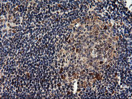 EPM2AIP1 Antibody in Immunohistochemistry (Paraffin) (IHC (P))