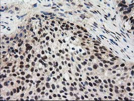 EPM2AIP1 Antibody in Immunohistochemistry (Paraffin) (IHC (P))