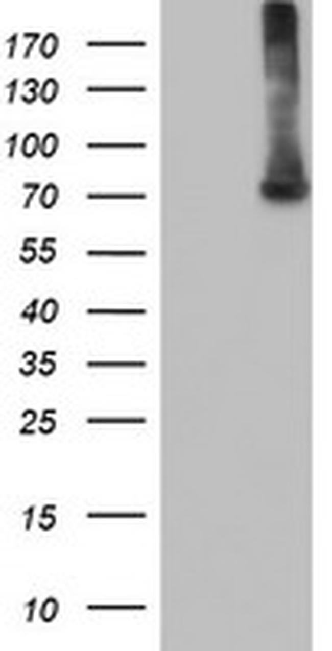 EPM2AIP1 Antibody in Western Blot (WB)