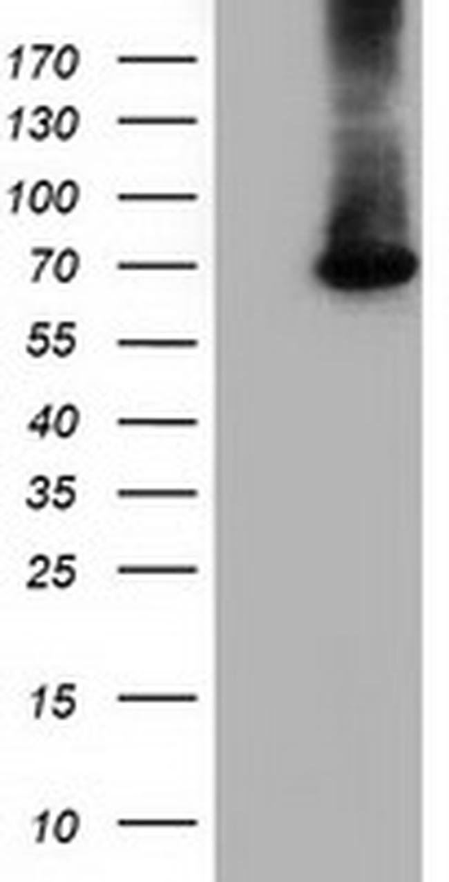 EPM2AIP1 Antibody in Western Blot (WB)