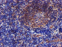 EPN2 Antibody in Immunohistochemistry (Paraffin) (IHC (P))