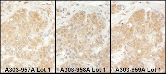 EPRS Antibody in Immunohistochemistry (IHC)