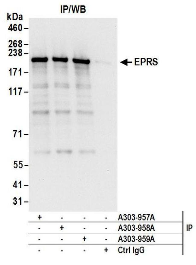 EPRS Antibody in Western Blot (WB)