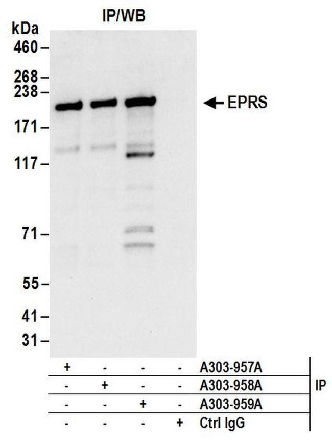 EPRS Antibody in Western Blot (WB)