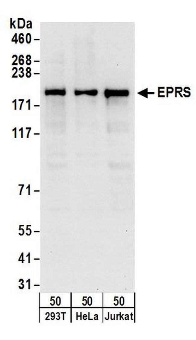 EPRS Antibody in Western Blot (WB)