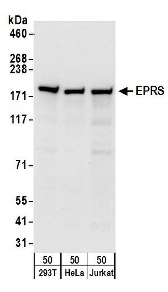 EPRS Antibody in Western Blot (WB)