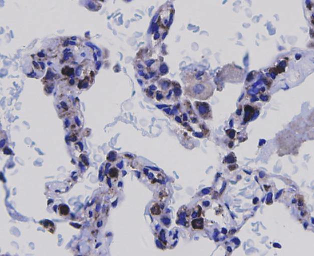 NF-kappa B p65 Antibody in Immunohistochemistry (Paraffin) (IHC (P))