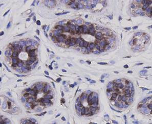 NF-kappa B p65 Antibody in Immunohistochemistry (Paraffin) (IHC (P))