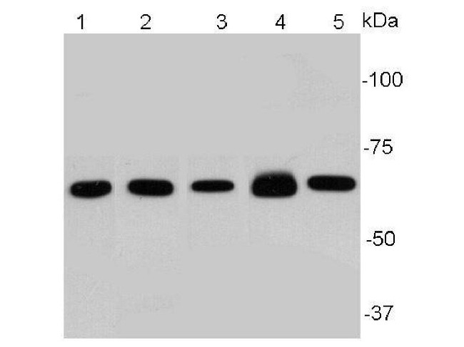 NF-kappa B p65 Antibody in Western Blot (WB)