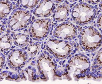 ERK1 Antibody in Immunohistochemistry (Paraffin) (IHC (P))