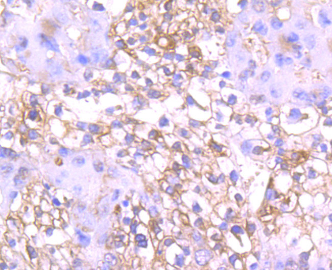 DKK1 Antibody in Immunohistochemistry (Paraffin) (IHC (P))