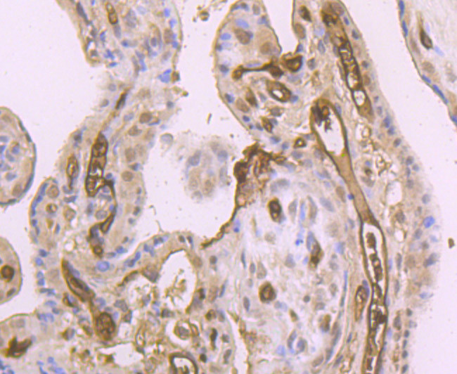 DKK1 Antibody in Immunohistochemistry (Paraffin) (IHC (P))