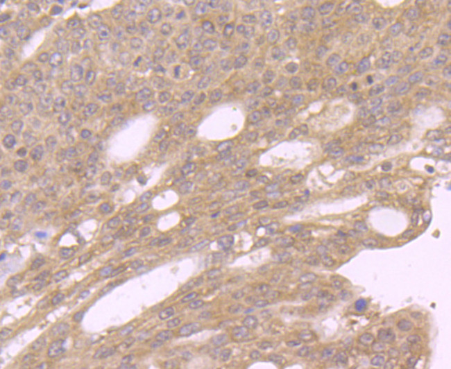 GOLPH3 Antibody in Immunohistochemistry (Paraffin) (IHC (P))