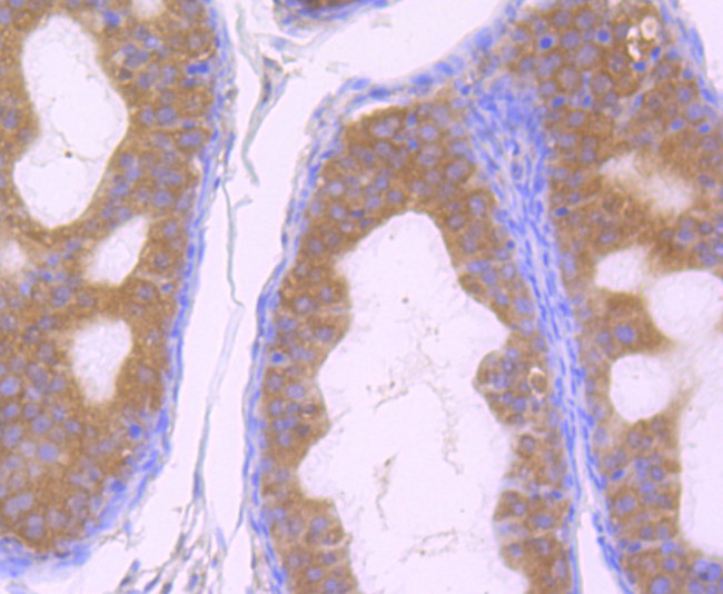 GOLPH3 Antibody in Immunohistochemistry (Paraffin) (IHC (P))