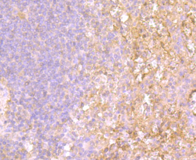 TLR4 Antibody in Immunohistochemistry (Paraffin) (IHC (P))