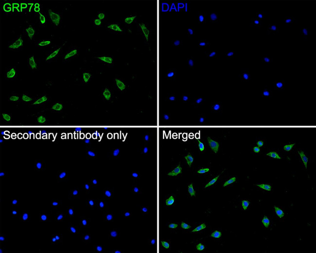 GRP78 Antibody in Immunocytochemistry (ICC/IF)