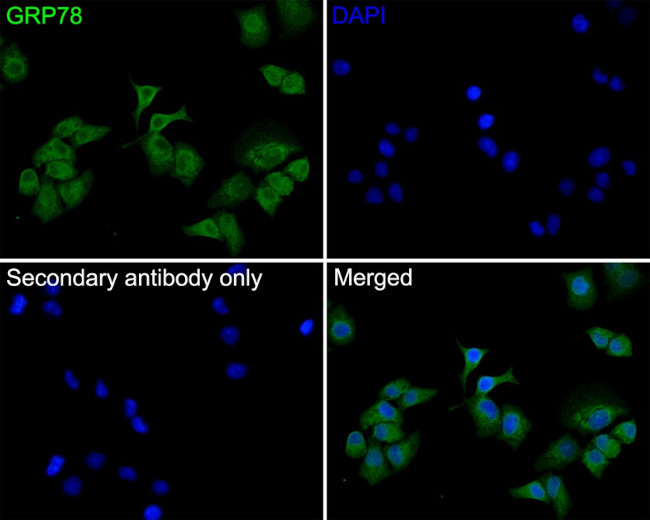 GRP78 Antibody in Immunocytochemistry (ICC/IF)