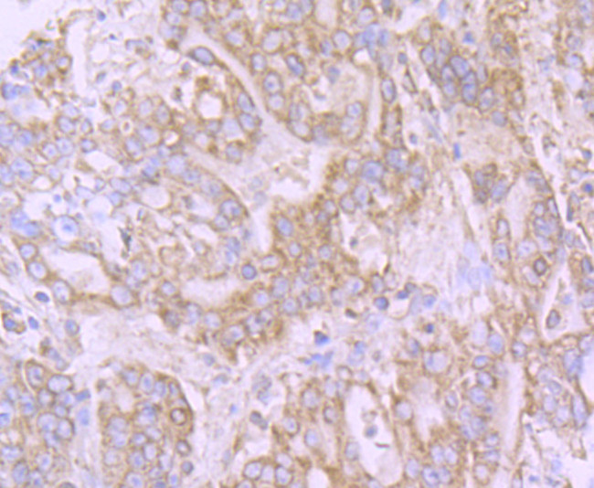 GRP78 Antibody in Immunohistochemistry (Paraffin) (IHC (P))