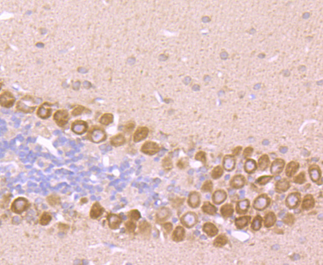 GRP78 Antibody in Immunohistochemistry (Paraffin) (IHC (P))