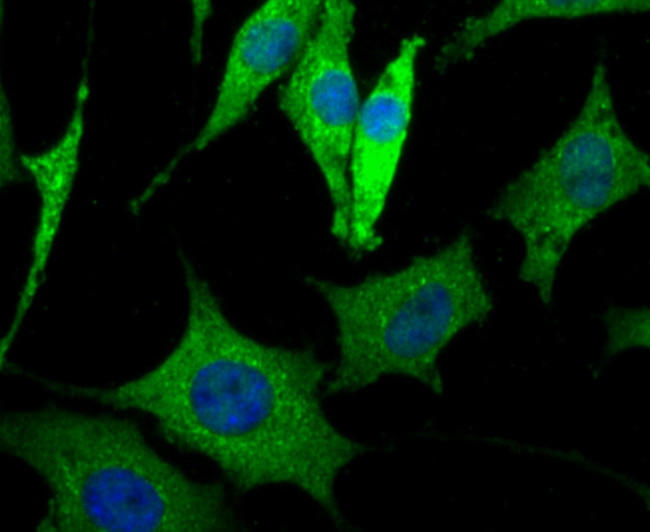 LRRK2 Antibody in Immunocytochemistry (ICC/IF)