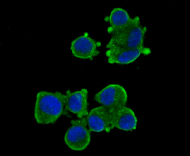 LRRK2 Antibody in Immunocytochemistry (ICC/IF)