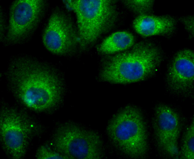 LRRK2 Antibody in Immunocytochemistry (ICC/IF)