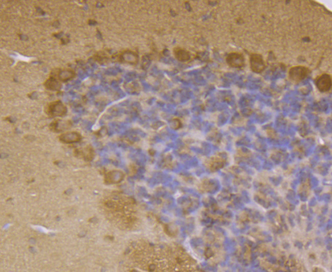 LRRK2 Antibody in Immunohistochemistry (Paraffin) (IHC (P))