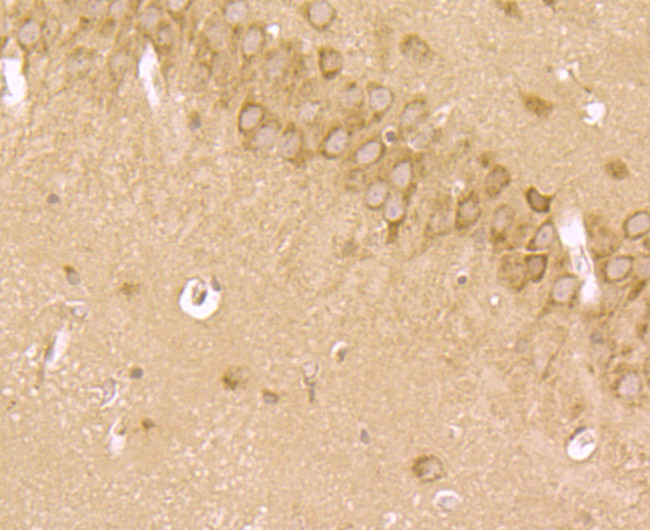 LRRK2 Antibody in Immunohistochemistry (Paraffin) (IHC (P))