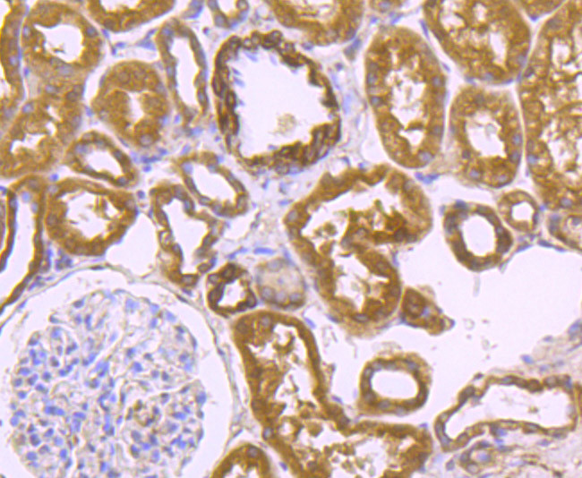 LRRK2 Antibody in Immunohistochemistry (Paraffin) (IHC (P))