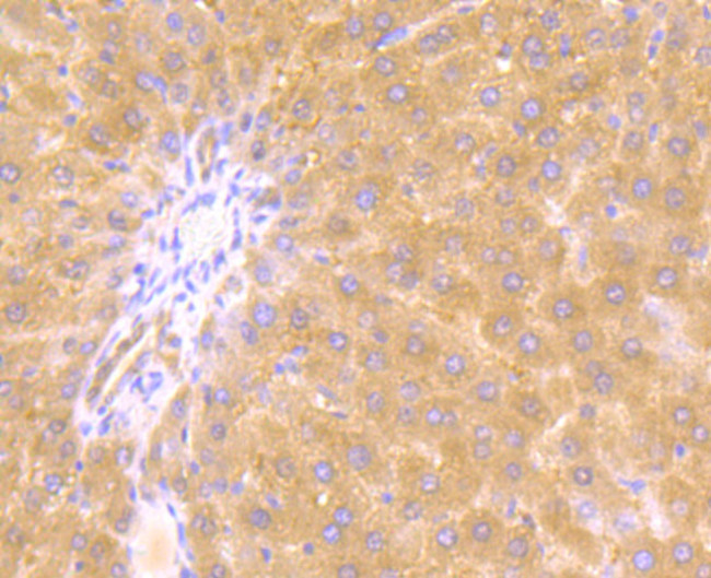 JAK2 Antibody in Immunocytochemistry (ICC/IF)