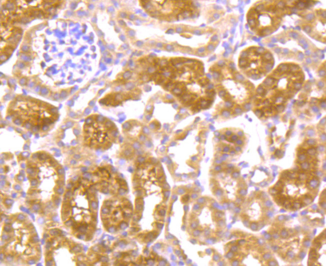 JAK2 Antibody in Immunohistochemistry (Paraffin) (IHC (P))