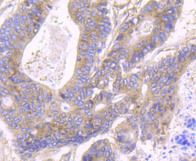 JAK2 Antibody in Immunohistochemistry (Paraffin) (IHC (P))