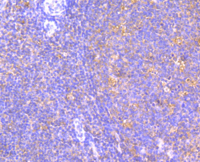 JAK2 Antibody in Immunohistochemistry (Paraffin) (IHC (P))