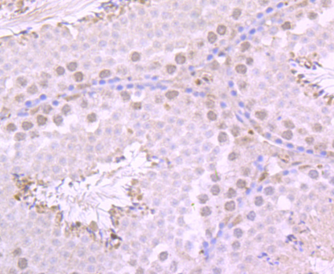 USP36 Antibody in Immunohistochemistry (Paraffin) (IHC (P))