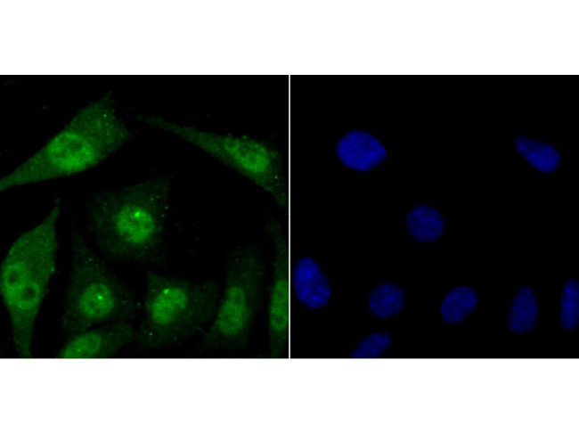 FBXW7 Antibody in Immunocytochemistry (ICC/IF)